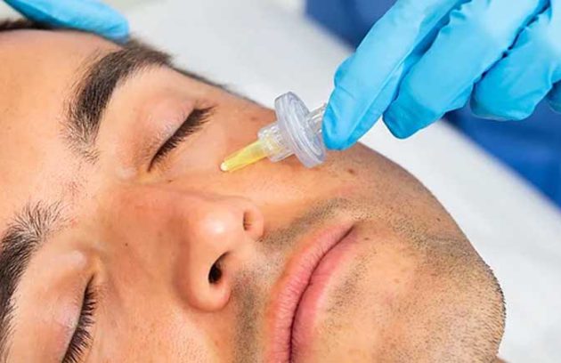 آیا کربوکسی تراپی برای درمان لک صورت موثر است؟