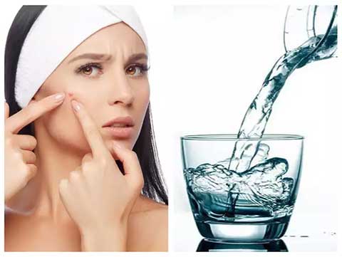 جلوگیری از ایجاد جوش‌های پوستی با خوردن آب کافی